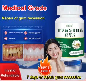 【Buy 2  Free 1】[The Iron Bowl Is Bitten to Pieces]Licorice Dandelion Angelica Tuckahoe Tablets/Teeth-Fixing Tablets for Loose Teeth 甘草蒲公英白芷茯苓片