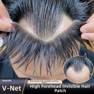 KEQIAO | M-Shaped Hairline Supplement Frontal Hairpiece