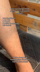 KISANA Hair Removal Cream Krim Perontok Bulu Tanpa Rasa Sakit BPOM 30ml