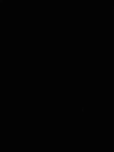 TW22774 Set 2 ชิ้น เสื้อลูกไม้ อกร้อยเชือก + กระโปรงลูกไม้ อกเสริมฟองน้ำ