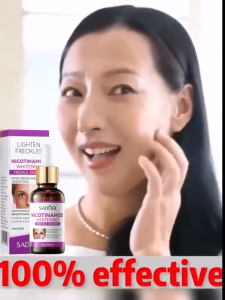 KADAIE SADOER Whitening Freckle Essence Remove Dark Spots Anti Freckle Essence Niacinamide Fade Pigmentation Melasma Brighten Melasma Retinol Essence 100ML BloomifyBeautyShop