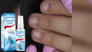 Ximonth Nail Fungus Foot Spray Nail pembaikan kulat semburan Anti jangkitan kuku penyembuhan kulat 30ml