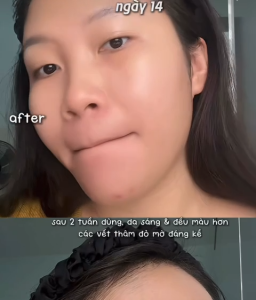 Serum Trẻ Hoá Phục Hồi Da Lão Hoá Da Sạm Nám LCL To Deepondé Glutathione Toning Ampoule Deeponde 30ml