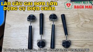 Lăn Cầu Gai Lớn Đơn (tròn) - Dụng Cụ Diện Chẩn