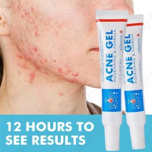 SADOER | Salicylic Acid Acne Faded Face Cream Reduce Pimple Spots Deep Cleaning Pore Anti-acne Scar Oil Control Moisturizer Skin Care