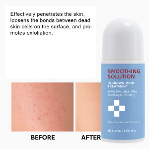 50ML Smoothing Solution Ingrown Hair Treatment Oil Control Exfoliating Skin Care Products Makes Skin Smoother
