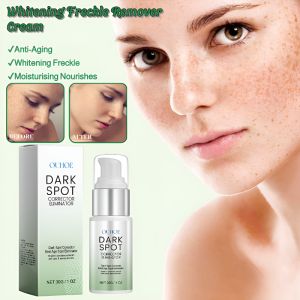 Freckle Removal Cream Freckle Whitening Cream Lightens Skin Tone Nourishes Skin Moisturizing Cream