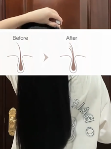 【SG SELLER】Scalp Medicine Supplying Device Head Ball Hair Smear Hair Care Oil Tool Medical Spacer Inhaler