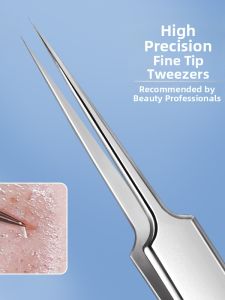 WIND LOVES FLOWERS | Pimple and Blackhead Remover Titanium Acne Tweezers
