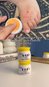 Skin Healing Cream Relief Itchy Skin Eczema Fungus Herbal Cream Anti-Allergic Skin Itching Antibacterial Ubat gatal kulit