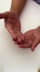 🔥KRIM BIDARA GELENGGANG RUQYAH UNTUK ECZEMA & KEGATALAN