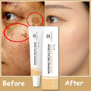 [Malaysia warehouse 24 hours delivery]Freckle Removal Cream 20g Black Spot Removing Cream Whitening Moisturizing Firming Removing Dark Circles Anti-aging