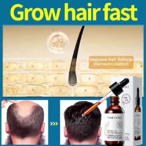 Hair Growth Serum Hair serum Hair Tonic 60ml Plant Essence Hair Growth Natural Hair Loss Herbal Anti Hair Loss Promote Menghalang kehilangan rambut