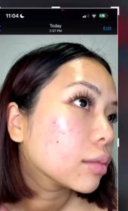 [Exp.2027 France] Caudalie Vinopure Salicylic Spot Solution 15ml by SkinCaring18 EU
