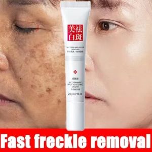 2pcs Freckle Removal Cream Whitening Anti Melasma Removal and Dark Spots Cream Effective Acne Scars 20g Pimple Scar Removal Cream Freckle Remover - Lazada
