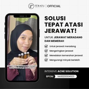 Bundle 2 PCS TERATU BEAUTY Intensive Acne Solution (Acne Spot Totol Jerawat untuk Jerawat Meradang dan Memerah)