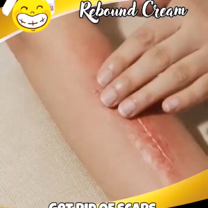 รอยแผลเป็น ครีมลบรอยแผลเป็น ครีมทาแผลเป็น แผลไฟไหม้ รอยสิว รอย เจลซ่อมแซม เจลรอยแผลเป็น รอยแผลเป็น แผลผ่าตัด น้ำร้อนลวก