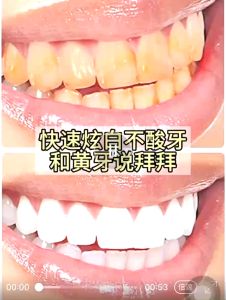 Comes 9D White Gel Teeth Quick Acting Whitening Tooth Strips Oral Care Hygiene Dazzling Double Tooth Dental Bleaching Tooth Sticker 美白牙齿贴