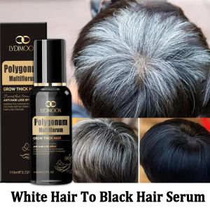 Polygonum Multiflorum Black Hair Serum 110ml Eliminate Gray Hair Permanent Black Hair White Hair To Black Hair Spray Herbal Essence Nourishes Black Hair Blackening from the roots