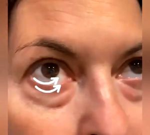 Anti-Wrinkle Eye Firming Oil Serum 10ml: Solusi Cepat Menghilangkan Keriput & Mata Panda