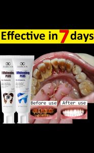 100g LYDIMOON Whitening Toothpaste Removes Smoke Stains Removes Coffee Stains Removes Tooth Stains Freshens Breath Reduces Plaque Fights Bad Breath