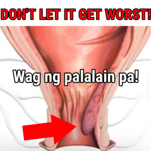 100% Authentic Hemorrhoids Treatment Hemoroids Cream Original Ointment Original Authentic HEMORRHOIDS Treatment RUSSIAN MIRACLE Ointment Cream Health Pain Relief