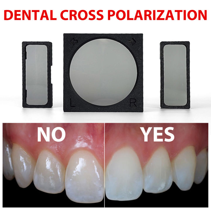 Cross Polarization Set For Dental Oral Photography - Godox MF12 Camera ...