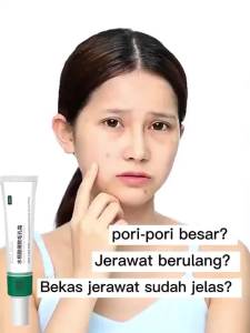 Krim Jerawat Efektif Mengatasi Jerawat & Bekas Jerawat