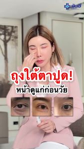 Yanhee Recovery Eye Serum ยันฮี รีโคฟเวอรี่ อาย ซีรั่ม ลดถุงใต้ตาบวมห้อย ริ้วรอย ตีนกา ใต้ตำดำ