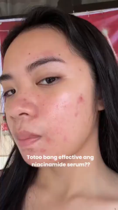 [Original HQ] Teashell Whitening Serum Face & Body Ampoule Serum Niacinamide Brightening Serum 5% Essence Darkspot Remover 30ml
