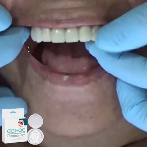 Eelhoe Adjustable Clip-On Dentures To Fill Braces And Dentures To Modify Teeth And Correct Teeth