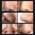 Masker Komedo Penghapus Komedo Breylee Blackhead Mask Step 1 & Breylee Pore Refining Serum Step 2 (17ml ) + 100pcs kertas blackhead remover | pengecil komedo pori pori kulit. 