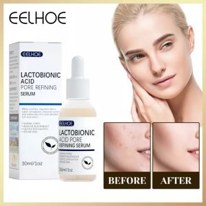 Serum Pengecil Pori & Penghilang Komedo: Eelhoe Pore Shrink Serum