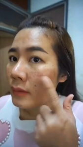 dr. FAY Cream 100% Original Penghilang Bopeng Flek Hitam Jerawat & Bekas Jerawat di Wajah Aman BPOM