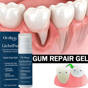 oralhoe | Rapid Repair Gums Gel Effectively Relieve Tooth Allergy Dental Caries Tooth Cleaning Toothpaste Relieve Tooth Damage Serum