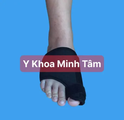 Nẹp bàn chân cố định Ngón Chân Cái