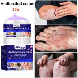 GL. Antibectiral cream Psoriasis Skin Care Cream for Eczema Chinese Herbal Compound Eczema Cream Anti Itch Cream For Itchy Skin And Allergy Quick Relief Itching For Skin Anti fungal Cream Skin care ointment 30g