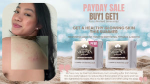 B2G2 Pinctada South Sea Pearl Skin Hydrating Soap with Niacinamide for Healing Blemishes Pimples & Bacne