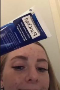 PanOxyl Sữa Rửa Mặt Peroxide 4% 170g - Kiểm Soát Dầu & Giảm Mẩn Đỏ  Giảm Viêm & Ngăn Mụn Quay Lại  Giảm Sưng Viêm & Ngừa Mụn Tái Phát Công Thức Không Bọt Dịu Nhẹ Cho Da Sạch Khô Thoáng Không Căng