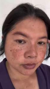 [ใหม่] ZINCOLTA PLUS ซินคลอต้า พลัส น้ำมันอะโวคาโด้ และ คอลลาเจน ลด สิว ฝ้า กระ ของแท้รับตรงจากบริษัท