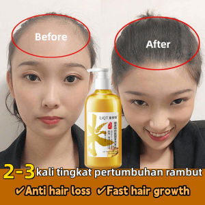 Jahe Shampoo Rambut Rontok Parah Wanita Sampo Anti Perontok 500ml Penumbuh Rambut Cepat