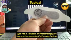 แผ่นปิดตาสำหรับการรักษาด้วยแสงเพื่อป้องกันดวงตาของทารกแรกเกิด 1 ชิ้น ที่ปิดตาเด็กส่องแสงบำบัดตัวเหลือง ทารกตัวเหลือง ภาวะตัวเหลือง ตาบอดจากแสง ตาบอดจากแสงแดด ตาบอดจากแสงแดด วิธีรักษา - Lazada