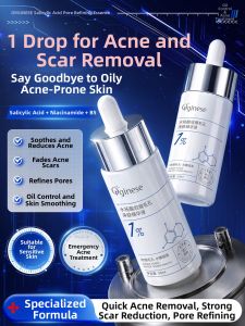 ORGINESE | Acne Treatment Serum For Acne Scar Reduction Oil Control Closed Comedones Pore Minimization