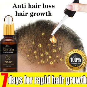 Anti Hair Loss Polygonum Multiflorum Serum Natural Plant Formula Strengthens Hair Follicles Promotes Hair Growth Nourishes Scalp 30ml