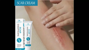 Scar Removal Cream 20g Fade All Scars: Acne Stretch Mark Keloid Burn Surgical & Mosquito Bite Old Marks