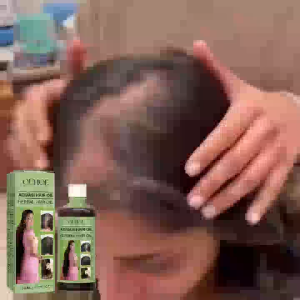 OUHOE  Herbal Hair Oil   Gentle Nourishing Scalp Strengthening Hair Cleansing Scalp Care Smooth Hair Oil