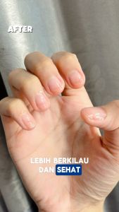 PREPARE Perawatan Kuku Kaki dan Tangan Serum Kuku Rusak Cantengan Vitamin Kuku Kutikula Obat Jamur Kuku Kaki dan Tangan Menicure
