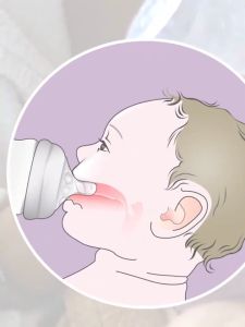 LAKOE Dot Untuk Puting Cocok Botol Leher Lebar Diameter 5.5CM