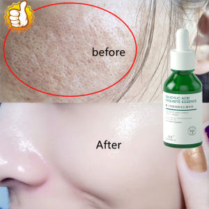 Salicylic Acid Serum Pore Minimizer Serum For Face 30ml Moisturizing Hydrating Repair Remove Blackhead Acne Shrink Pores Serum Firming Whitening Anti-Aging Facial Skin Care Moisturizing Essence