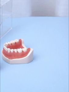 NICEDEN 15g Dental Temporary Sealing Paste Root Canal Treatment Temporary Filling Material Sealing King Rapid Curing Dentistry Materials